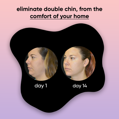 acholift - 4-in-1 facial sculptor